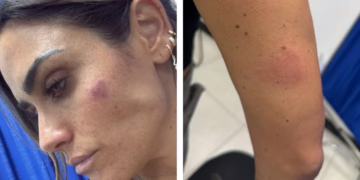 Alessandra Rojo de la Vega, fue agredida durante operativo en Ribera de San Cosme